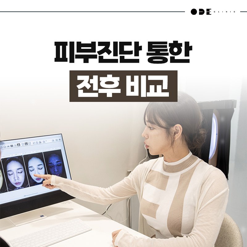 강남 팔자주름 눈밑 꺼짐 상담