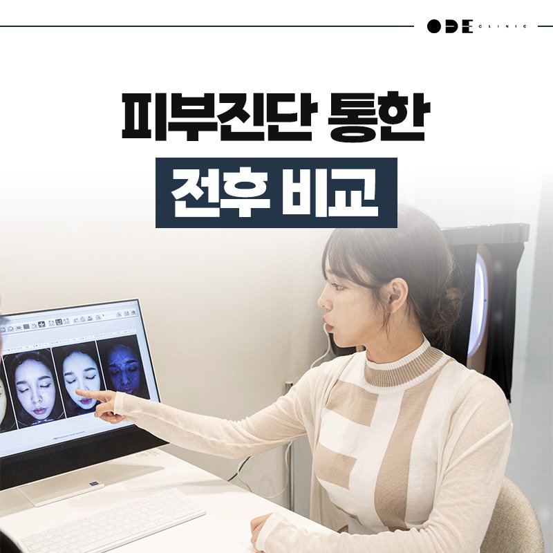 땅콩형얼굴이랑 볼꺼짐이 같이 고민인데 강남에서 상담 잘해주는 피부과 추천